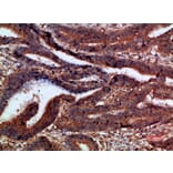 Immunohistochemistry - Anti-CTNND1 Antibody (C30834) - Antibodies.com