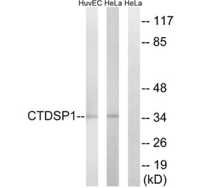 Western Blot - Anti-CTDSP1 Antibody (C14968) - Antibodies.com