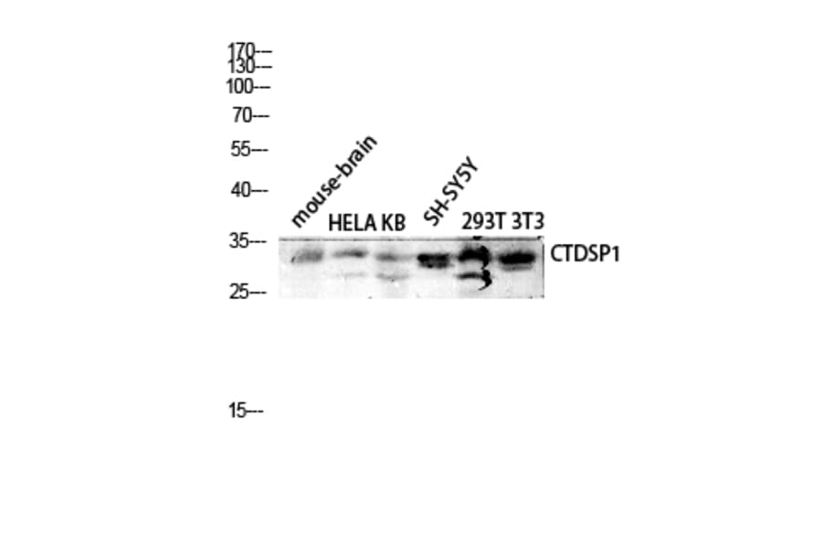 Western Blot - Anti-CTDSP1 Antibody (C14968) - Antibodies.com