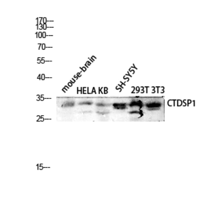 Western Blot - Anti-CTDSP1 Antibody (C14968) - Antibodies.com