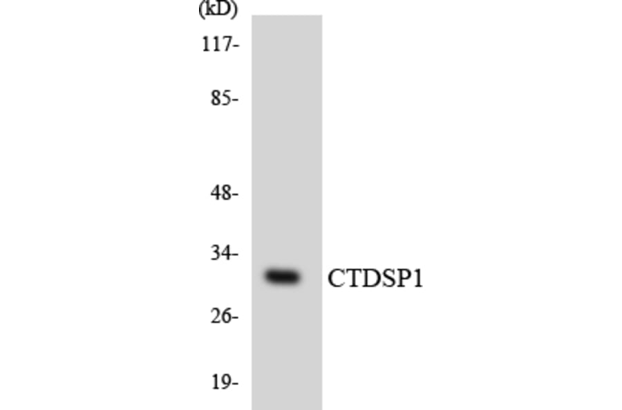 Western Blot - Anti-CTDSP1 Antibody (R12-2660) - Antibodies.com