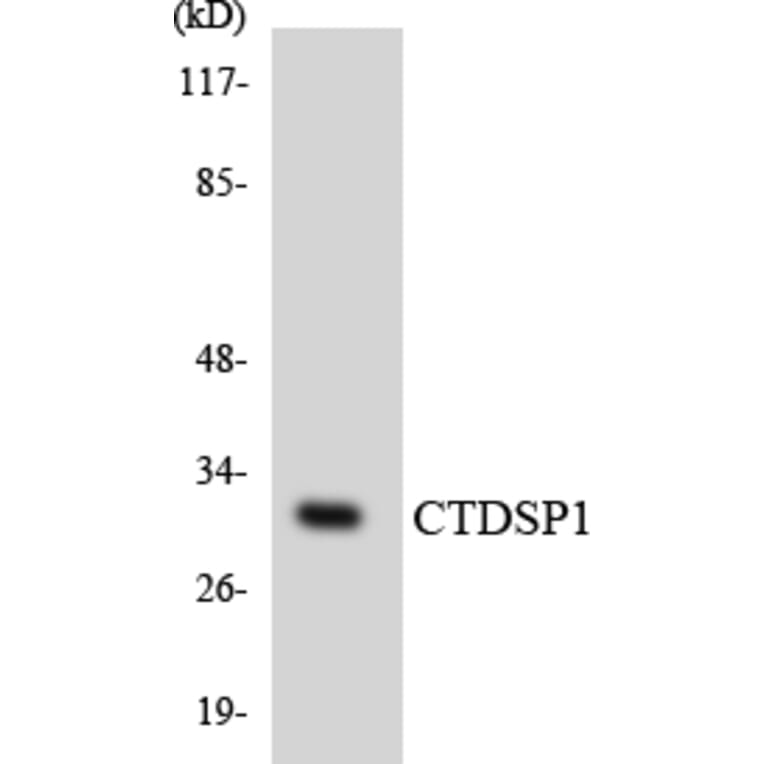 Western Blot - Anti-CTDSP1 Antibody (R12-2660) - Antibodies.com