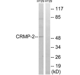 Western Blot - Anti-CRMP-2 Antibody (B8324) - Antibodies.com