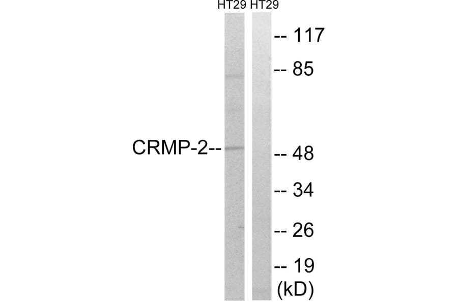 Western Blot - Anti-CRMP-2 Antibody (B8324) - Antibodies.com
