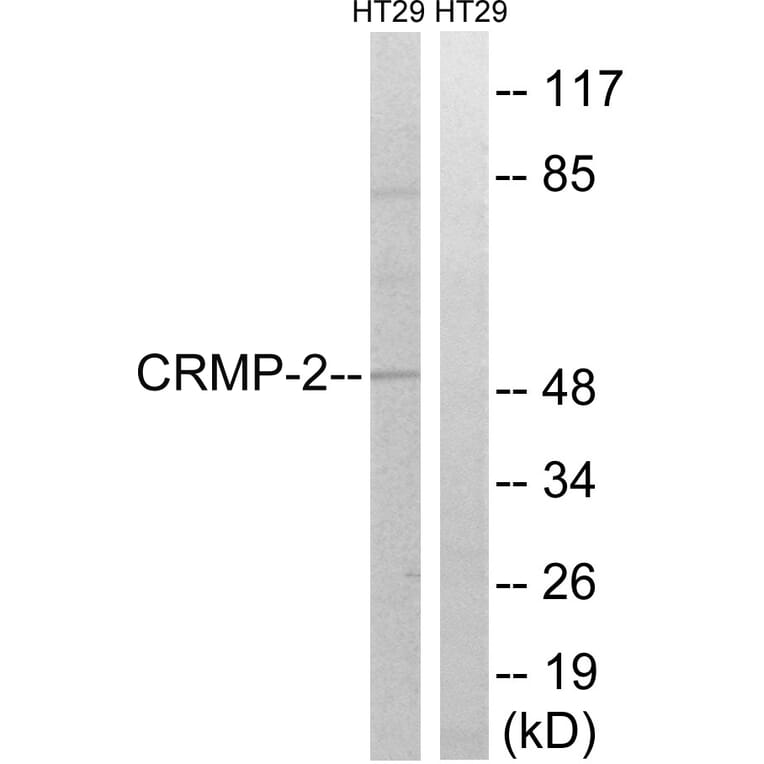 Western Blot - Anti-CRMP-2 Antibody (B8324) - Antibodies.com