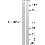 Western Blot - Anti-CRMP-2 Antibody (B8324) - Antibodies.com