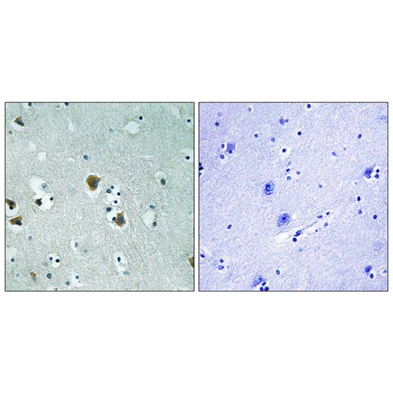 Immunohistochemistry - Anti-CRMP-2 Antibody (B8324) - Antibodies.com