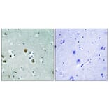 Immunohistochemistry - Anti-CRMP-2 Antibody (B8324) - Antibodies.com