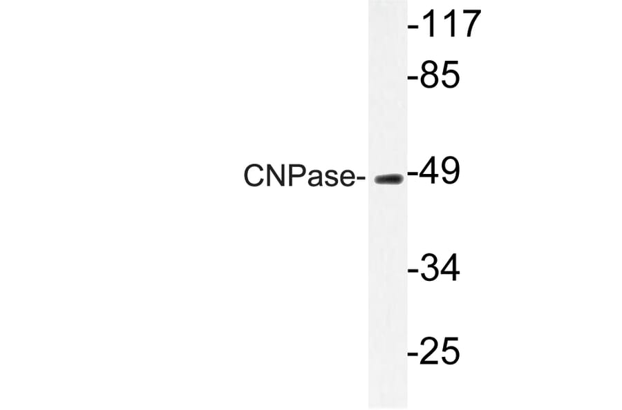 Western Blot - Anti-CNPase Antibody (R12-2096) - Antibodies.com