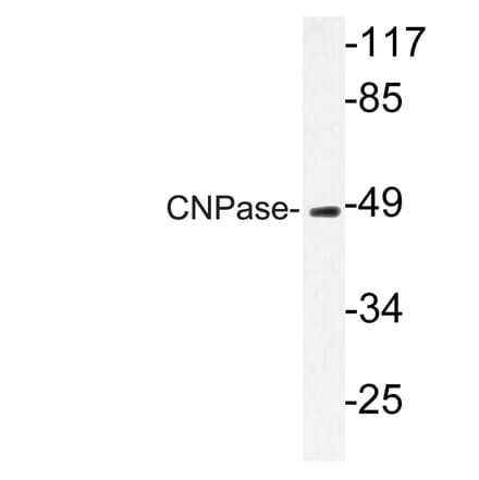 Western Blot - Anti-CNPase Antibody (R12-2096) - Antibodies.com