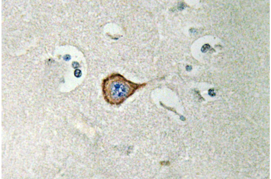 Immunohistochemistry - Anti-CNPase Antibody (R12-2096) - Antibodies.com