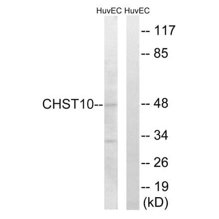 Western Blot - Anti-CHST10 Antibody (C14921) - Antibodies.com