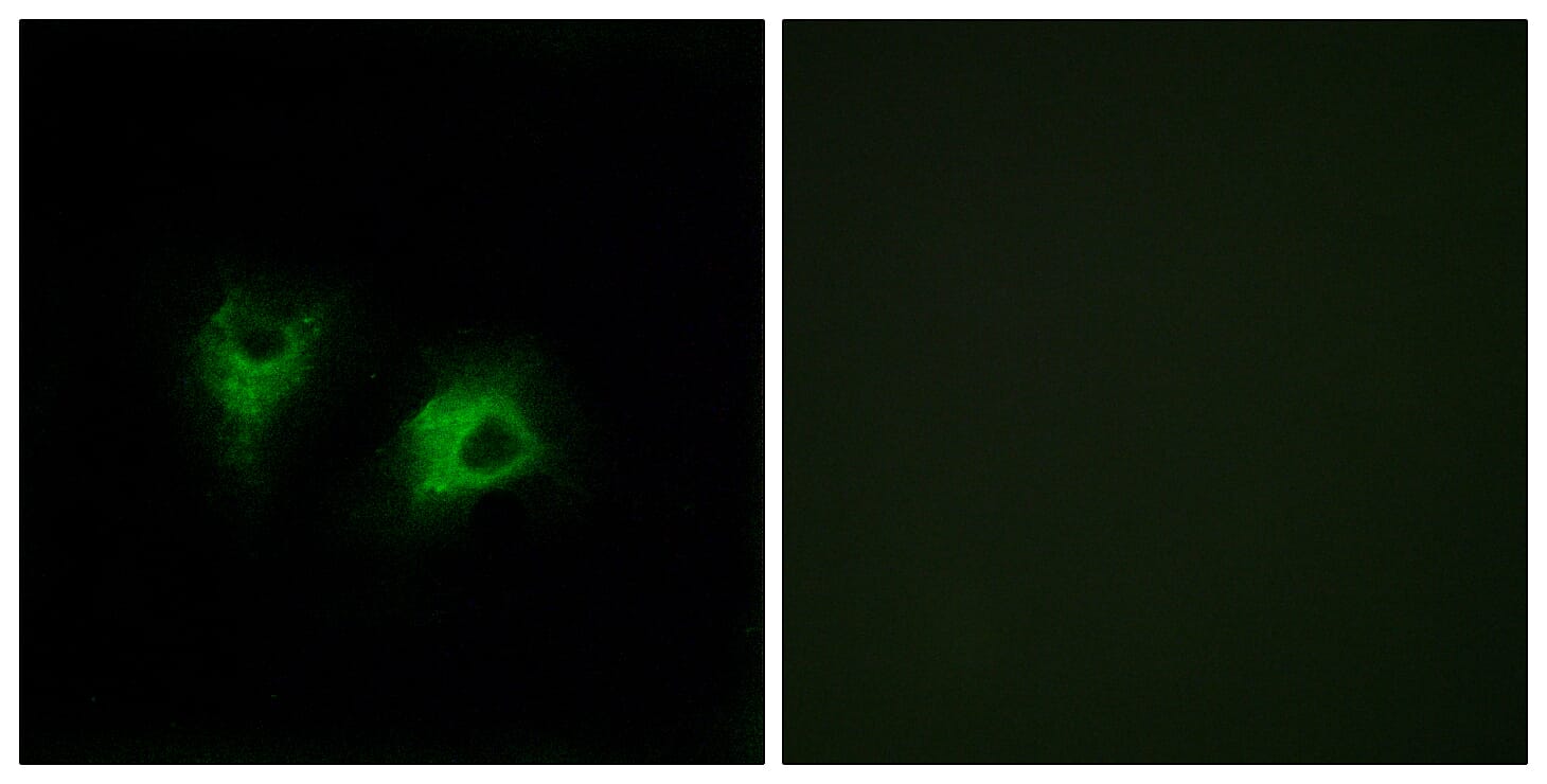 Immunofluorescence analysis of COS7 cells using Anti-CELSR2 Antibody. The right hand panel represents a negative control, where the antibody was pre-incubated with the immunising peptide.