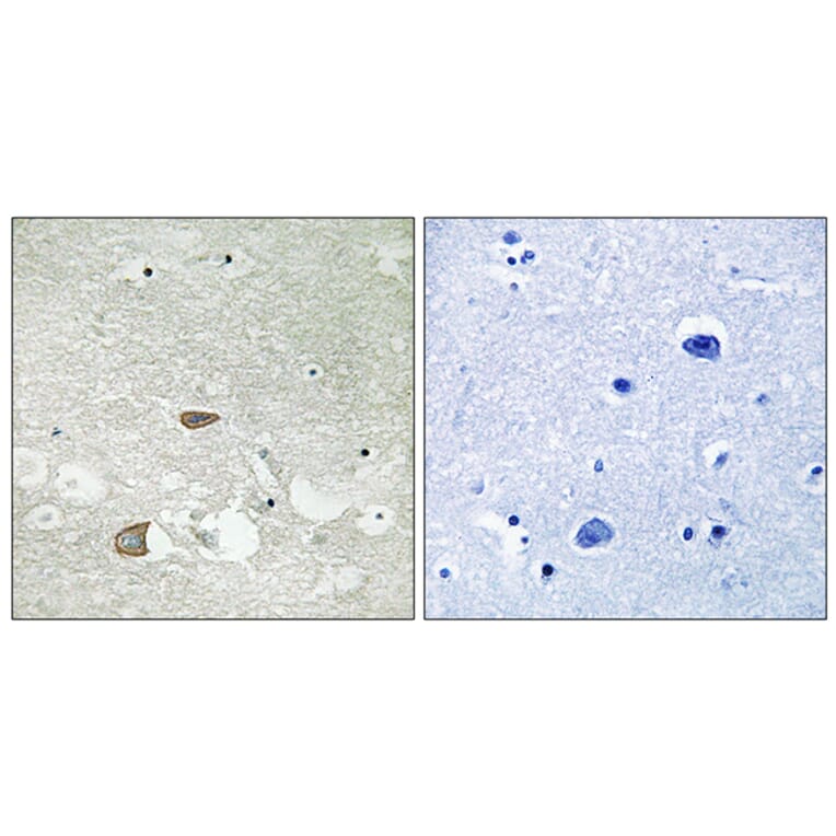 Immunohistochemistry - Anti-CELSR2 Antibody (C12183) - Antibodies.com