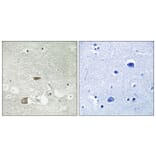 Immunohistochemistry - Anti-CELSR2 Antibody (C12183) - Antibodies.com