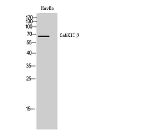 Western Blot - Anti-CAMKK2 Antibody (C21217) - Antibodies.com