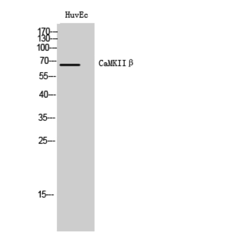Western Blot - Anti-CAMKK2 Antibody (C21217) - Antibodies.com