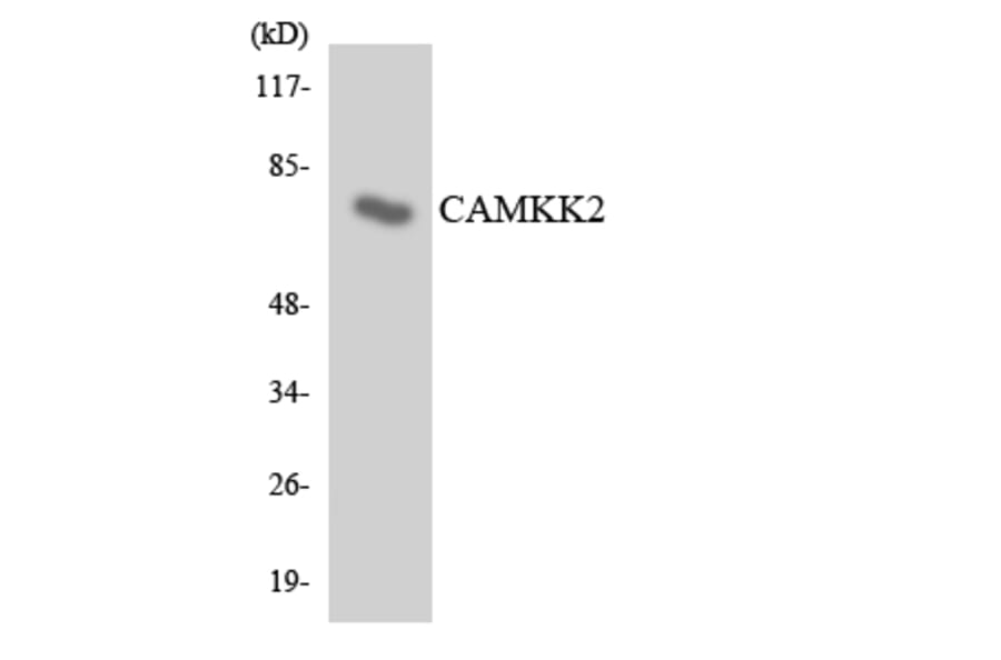 Western Blot - Anti-CAMKK2 Antibody (R12-2567) - Antibodies.com