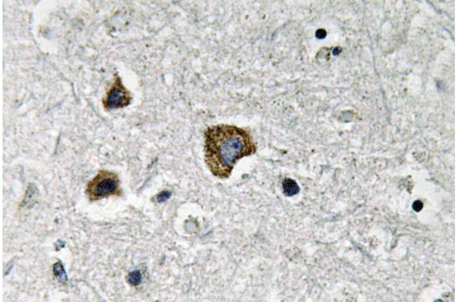 Immunohistochemistry - Anti-BNIP-3 Antibody (R12-2042) - Antibodies.com