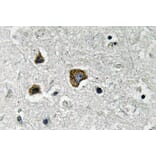 Immunohistochemistry - Anti-BNIP-3 Antibody (R12-2042) - Antibodies.com
