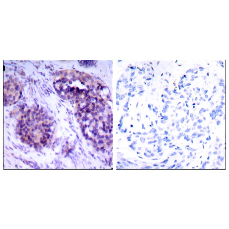Immunohistochemistry - Anti-BCL-XL Antibody (B7027) - Antibodies.com