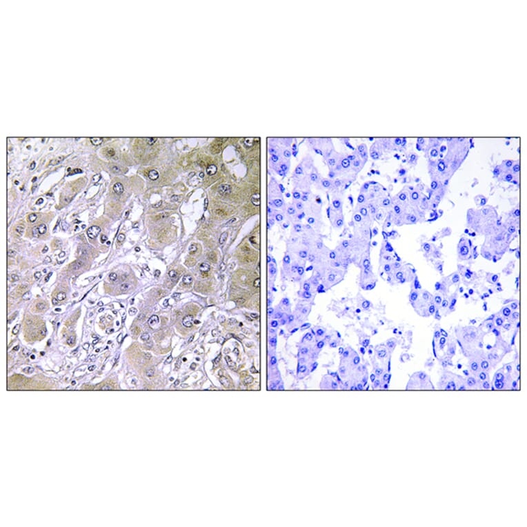 Immunohistochemistry - Anti-ACOT12 Antibody (C14270) - Antibodies.com