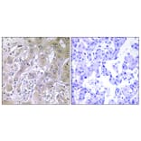 Immunohistochemistry - Anti-ACOT12 Antibody (C14270) - Antibodies.com