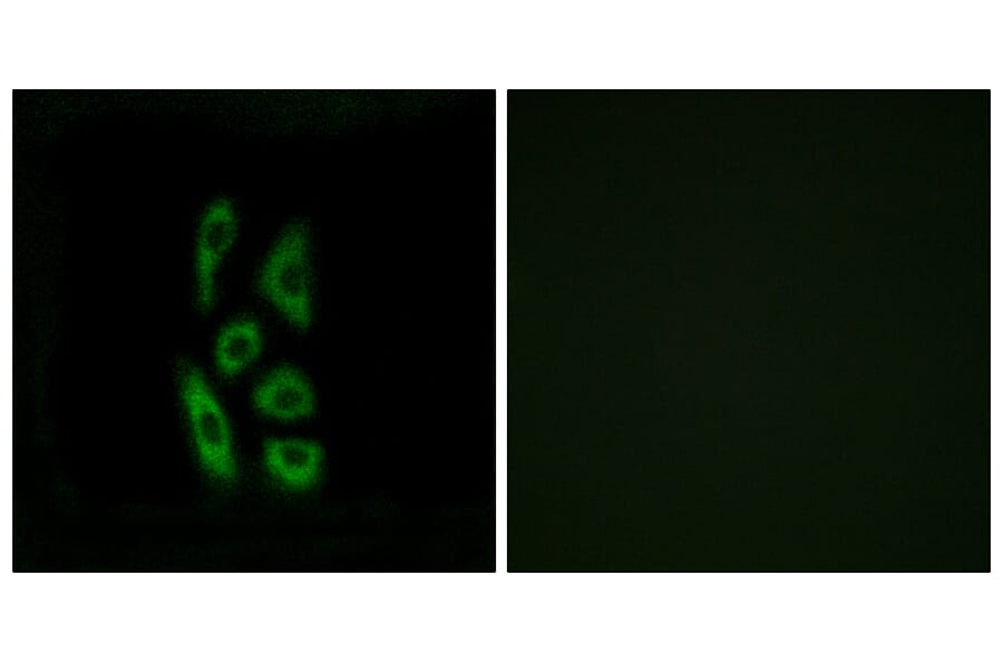 Immunofluorescence - Anti-ACOT12 Antibody (C14270) - Antibodies.com