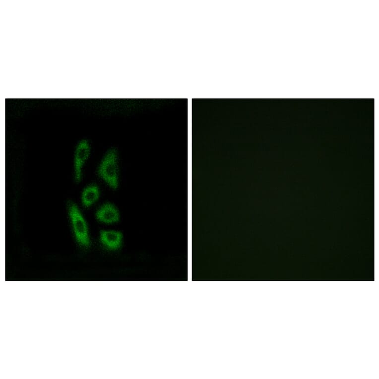 Immunofluorescence - Anti-ACOT12 Antibody (C14270) - Antibodies.com