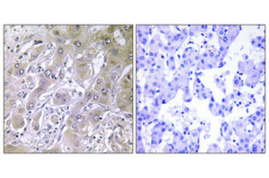 Immunohistochemistry - Anti-ACOT12 Antibody (C14270) - Antibodies.com