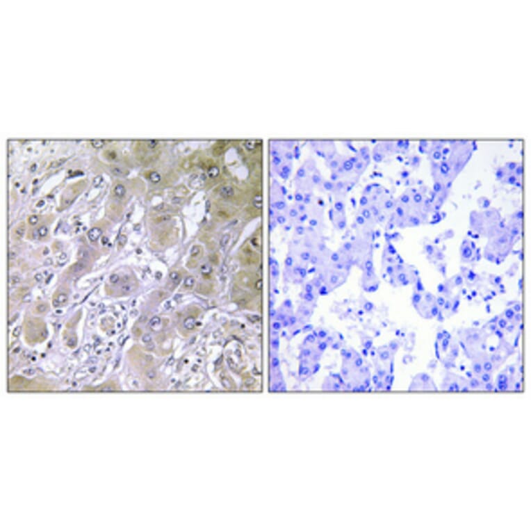 Immunohistochemistry - Anti-ACOT12 Antibody (C14270) - Antibodies.com