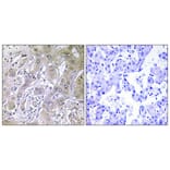 Immunohistochemistry - Anti-ACOT12 Antibody (C14270) - Antibodies.com