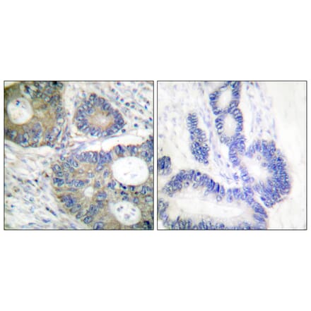 Immunohistochemistry - Anti-4E-BP1 Antibody (B0401) - Antibodies.com