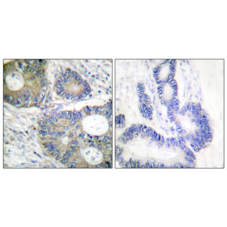 Immunohistochemistry - Anti-4E-BP1 Antibody (B0401) - Antibodies.com