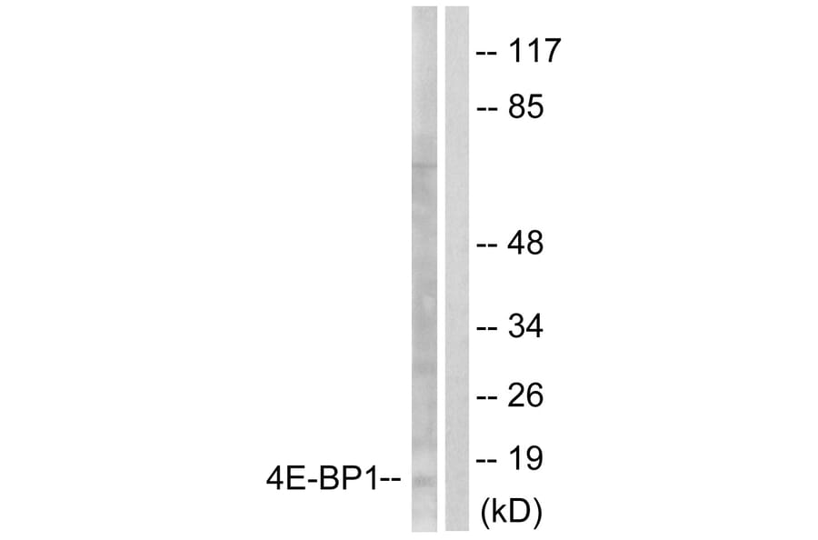 Western Blot - Anti-4E-BP1 Antibody (B0401) - Antibodies.com