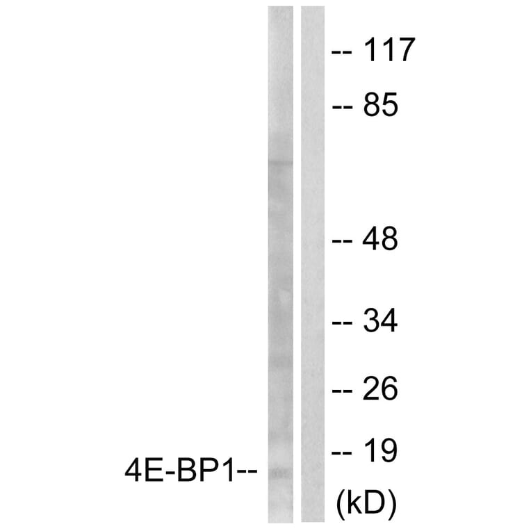 Western Blot - Anti-4E-BP1 Antibody (B0401) - Antibodies.com