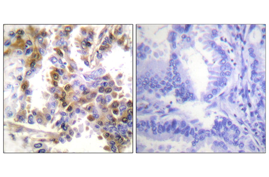 Immunohistochemistry - Anti-4E-BP1 Antibody (B0884) - Antibodies.com