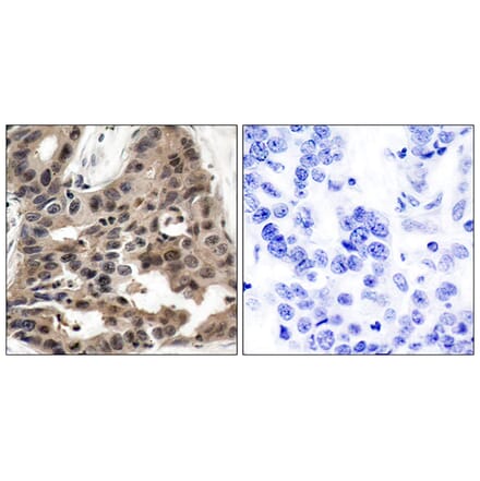 Immunohistochemistry - Anti-4E-BP1 Antibody (B7001) - Antibodies.com