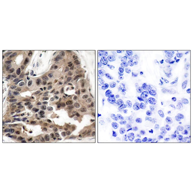 Immunohistochemistry - Anti-4E-BP1 Antibody (B7001) - Antibodies.com