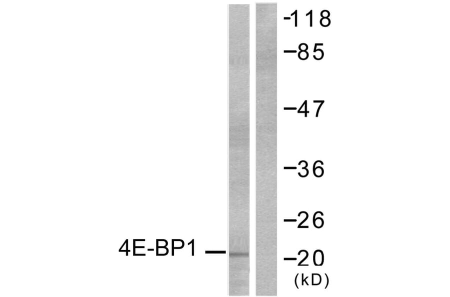 Western Blot - Anti-4E-BP1 Antibody (B7001) - Antibodies.com