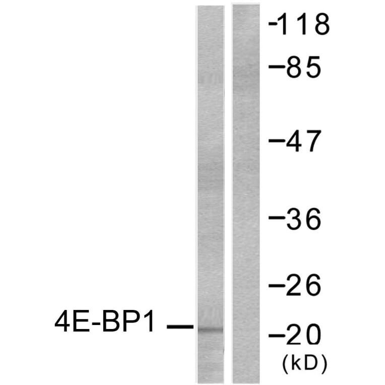 Western Blot - Anti-4E-BP1 Antibody (B7001) - Antibodies.com