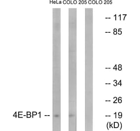 Western Blot - Anti-4E-BP1 Antibody (B7002) - Antibodies.com