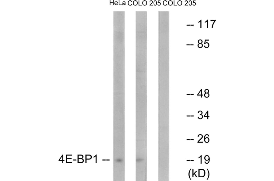 Western Blot - Anti-4E-BP1 Antibody (B7002) - Antibodies.com