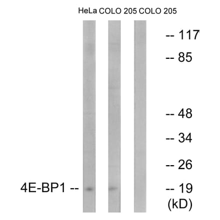 Western Blot - Anti-4E-BP1 Antibody (B7002) - Antibodies.com