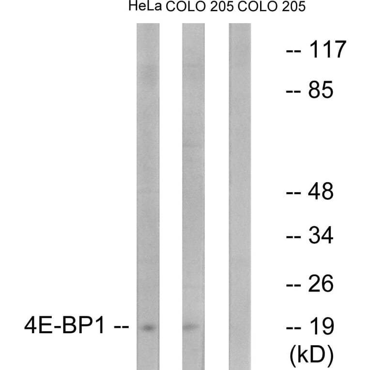 Western Blot - Anti-4E-BP1 Antibody (B7002) - Antibodies.com