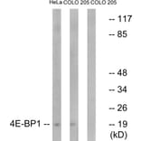 Western Blot - Anti-4E-BP1 Antibody (B7002) - Antibodies.com