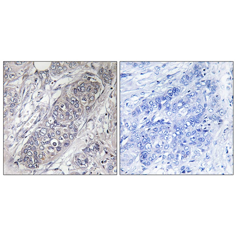 Immunohistochemistry - Anti-4E-BP1 Antibody (B7002) - Antibodies.com