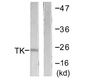 Western Blot - Anti-TK Antibody (B0586) - Antibodies.com