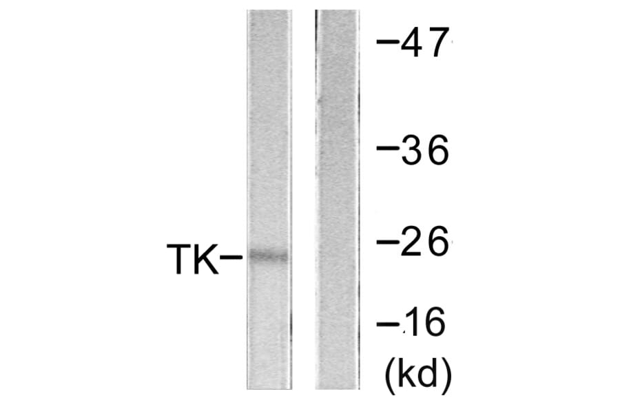 Western Blot - Anti-TK Antibody (B0586) - Antibodies.com