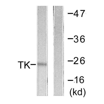 Western Blot - Anti-TK Antibody (B0586) - Antibodies.com